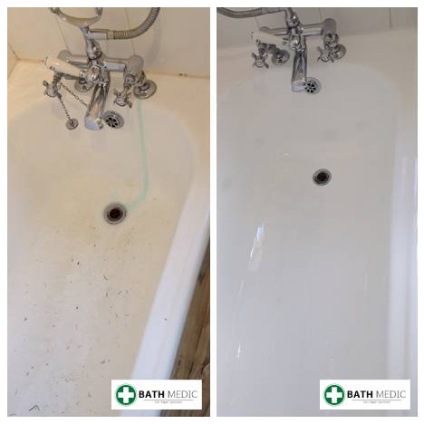 Bath resurfacing Brighton Queensbury Hotel — Bath Medic